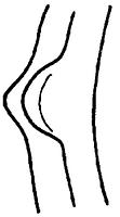 tekening - r-gra-11 - 11-91