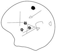 tekening - r-dov-1 - Myo14 1077-1