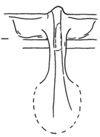 Afbeelding object 98alk3 - 86 - Alk98-92WOR-BP3 V
