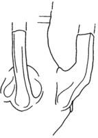 Afbeelding object 09oth2 - 11 - OH-LV-11